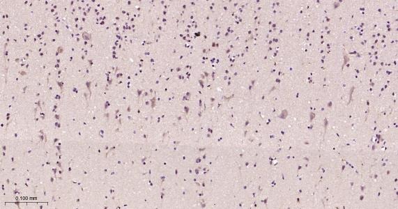 Anti-NGF Antibody (1M564)