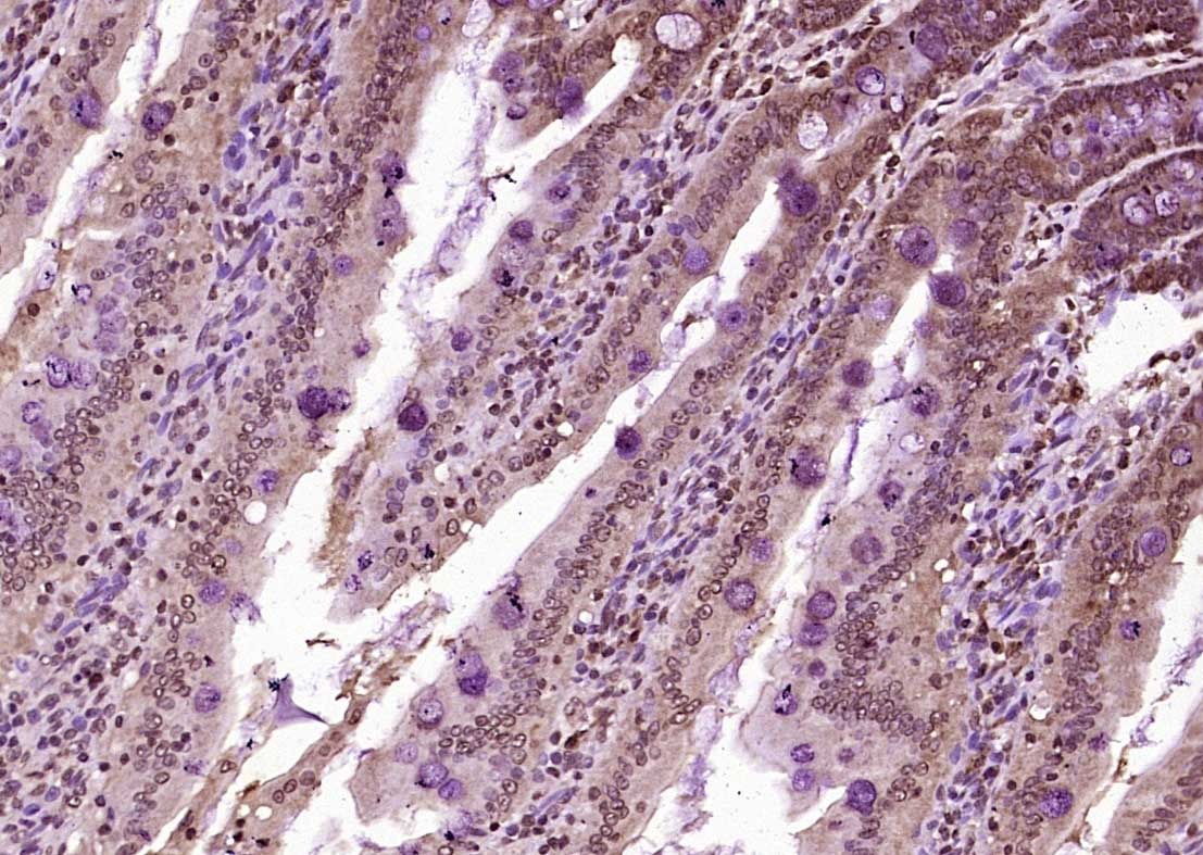 Anti-KIBRA Polyclonal Antibody