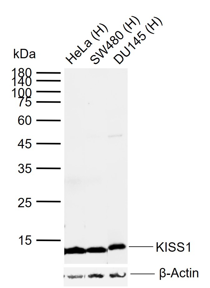 Anti-KISS1 Polyclonal Antibody