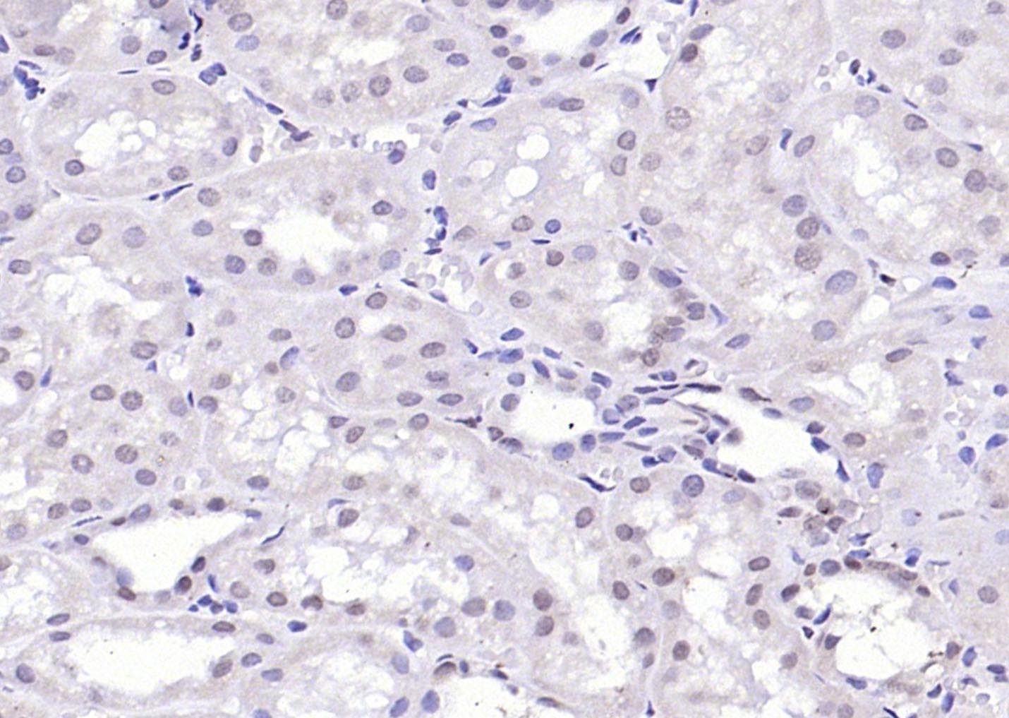 Anti-KLF2 Polyclonal Antibody