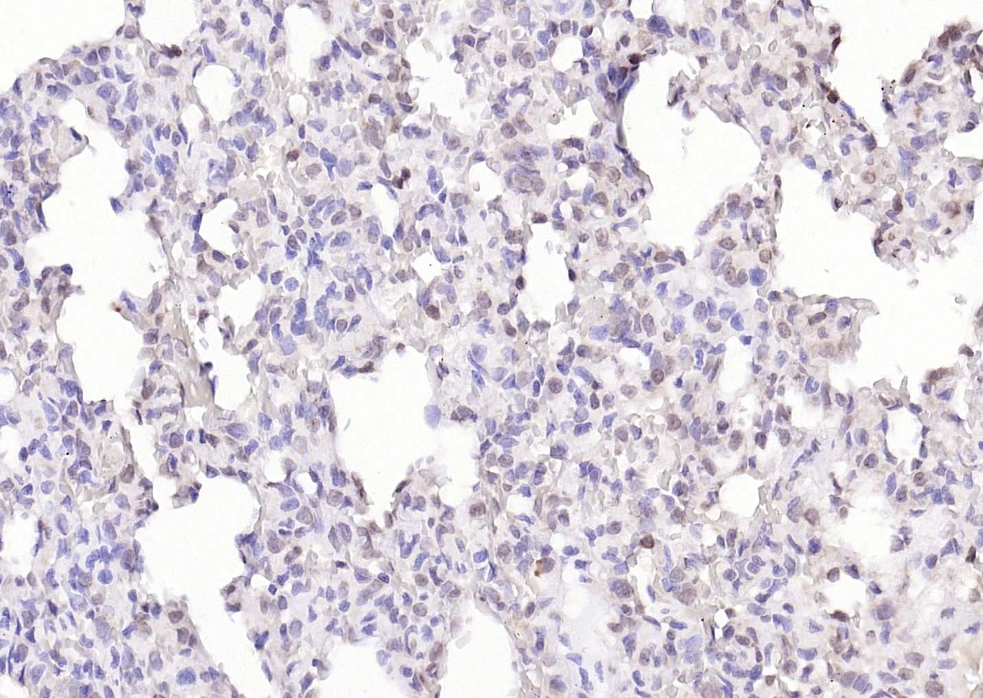 Anti-KIBRA Polyclonal Antibody