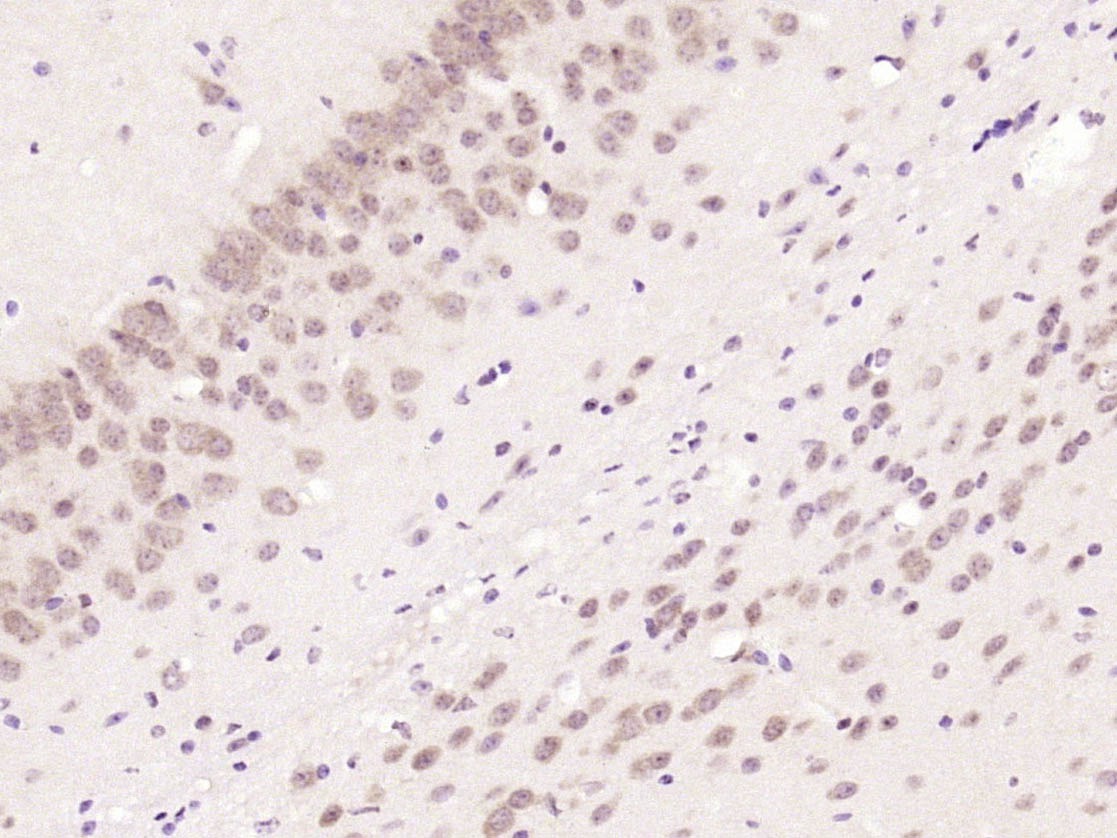 Anti-iNOS Polyclonal Antibody