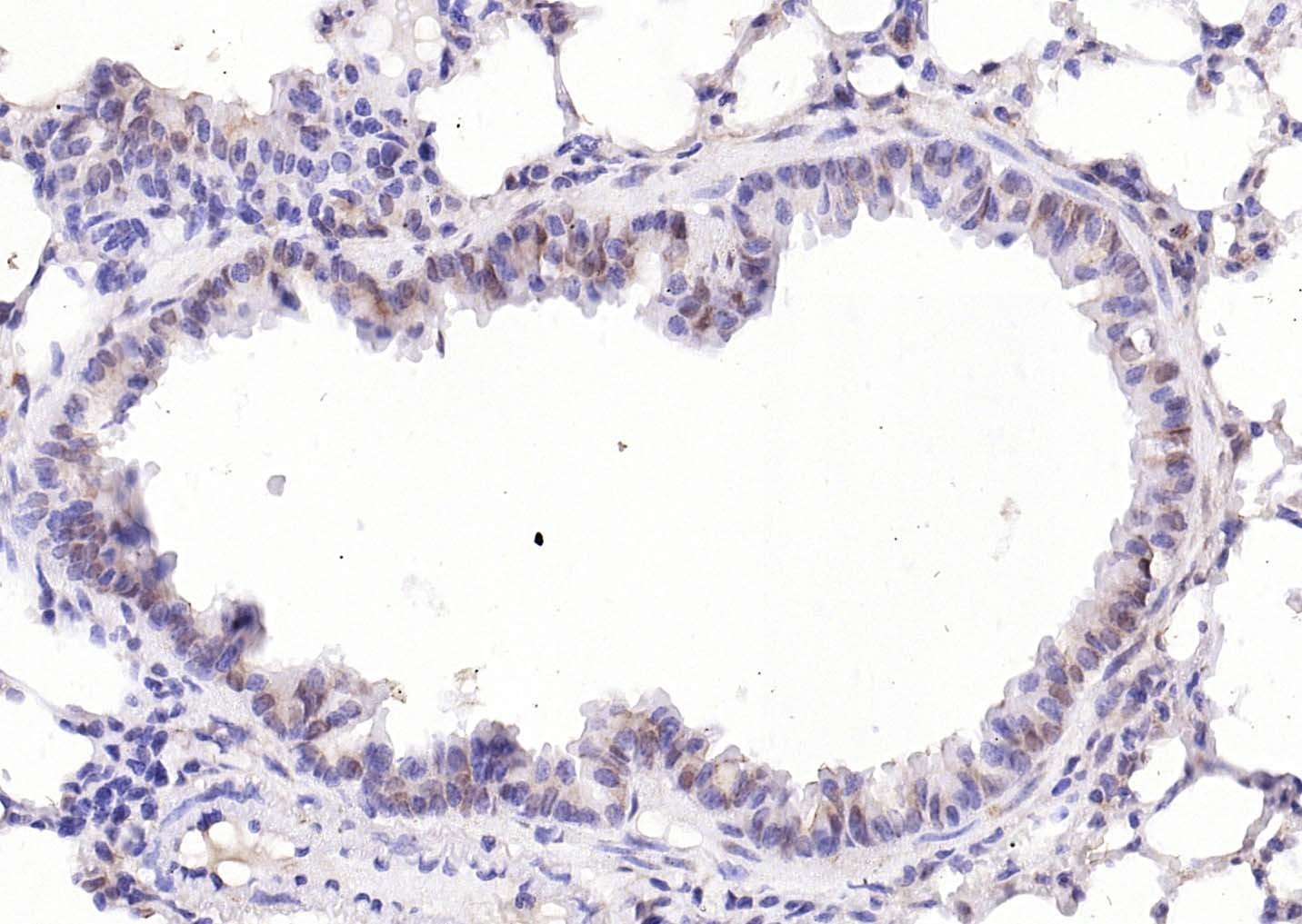 Anti-KIBRA Polyclonal Antibody
