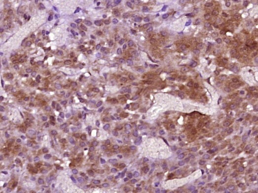 Anti-INHBB Polyclonal Antibody