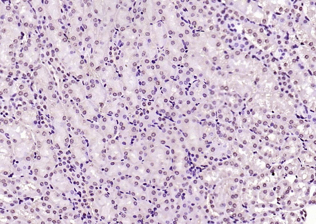 Anti-KEAP1 Polyclonal Antibody 2
