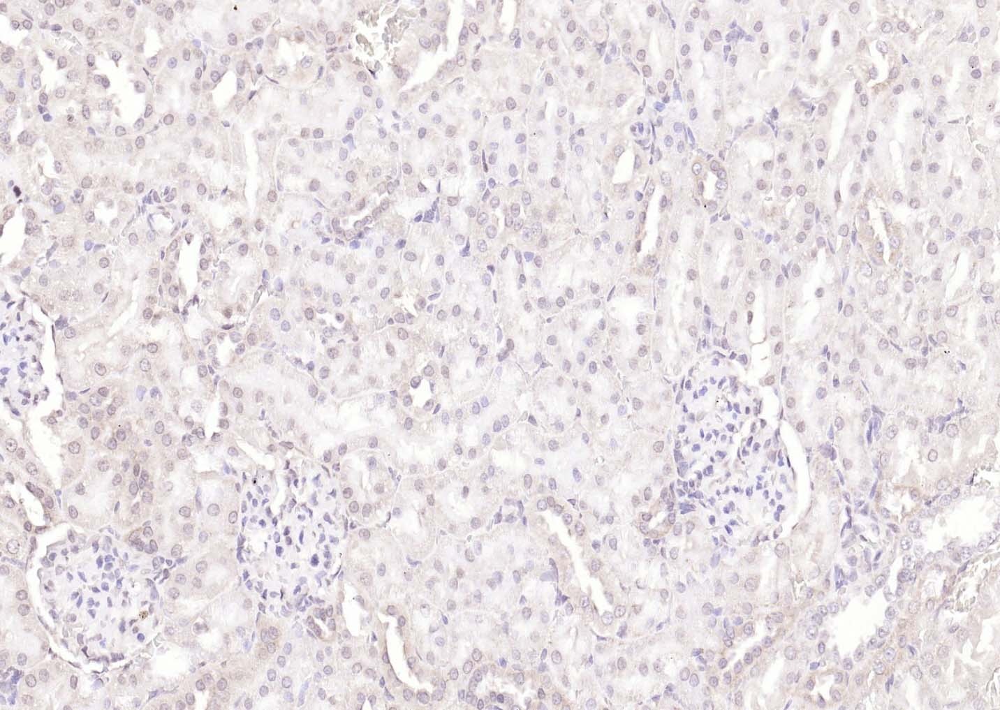 Anti-KIBRA Polyclonal Antibody