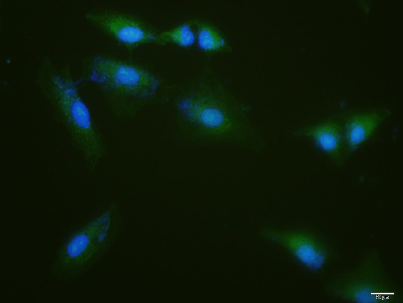 Anti-KEAP1 Polyclonal Antibody 2