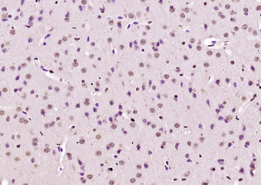 Anti-KIAA2022 Polyclonal Antibody