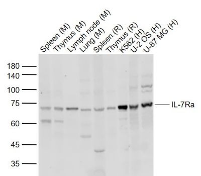 Anti-IL-7R alpha/CD127 Polyclonal Antibody