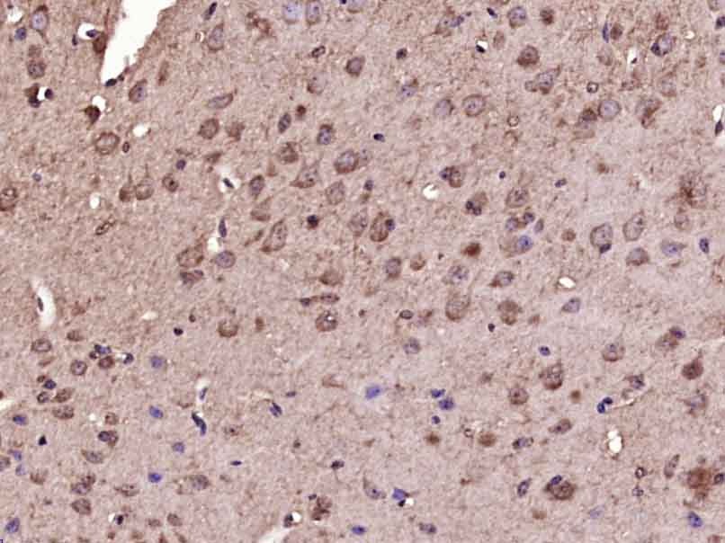 Anti-INHA Polyclonal Antibody