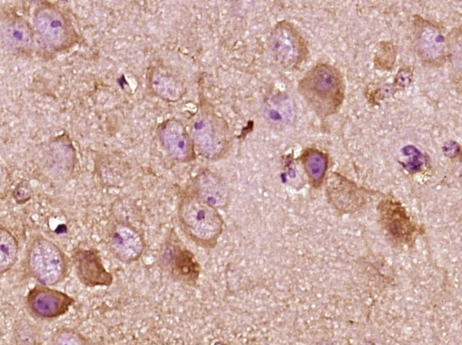 Anti-KISS1 Polyclonal Antibody