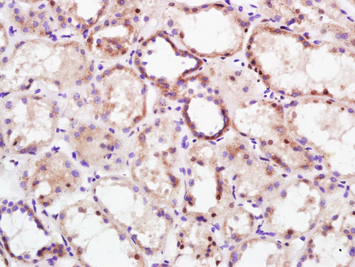 Anti-KEAP1 Polyclonal Antibody 2