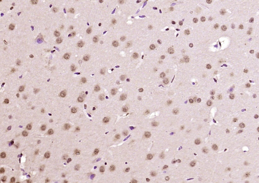 Anti-KIAA2022 Polyclonal Antibody