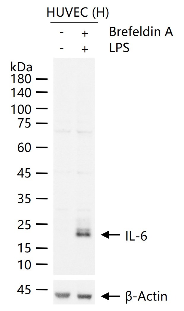 Anti-IL-6 Polyclonal Antibody 2