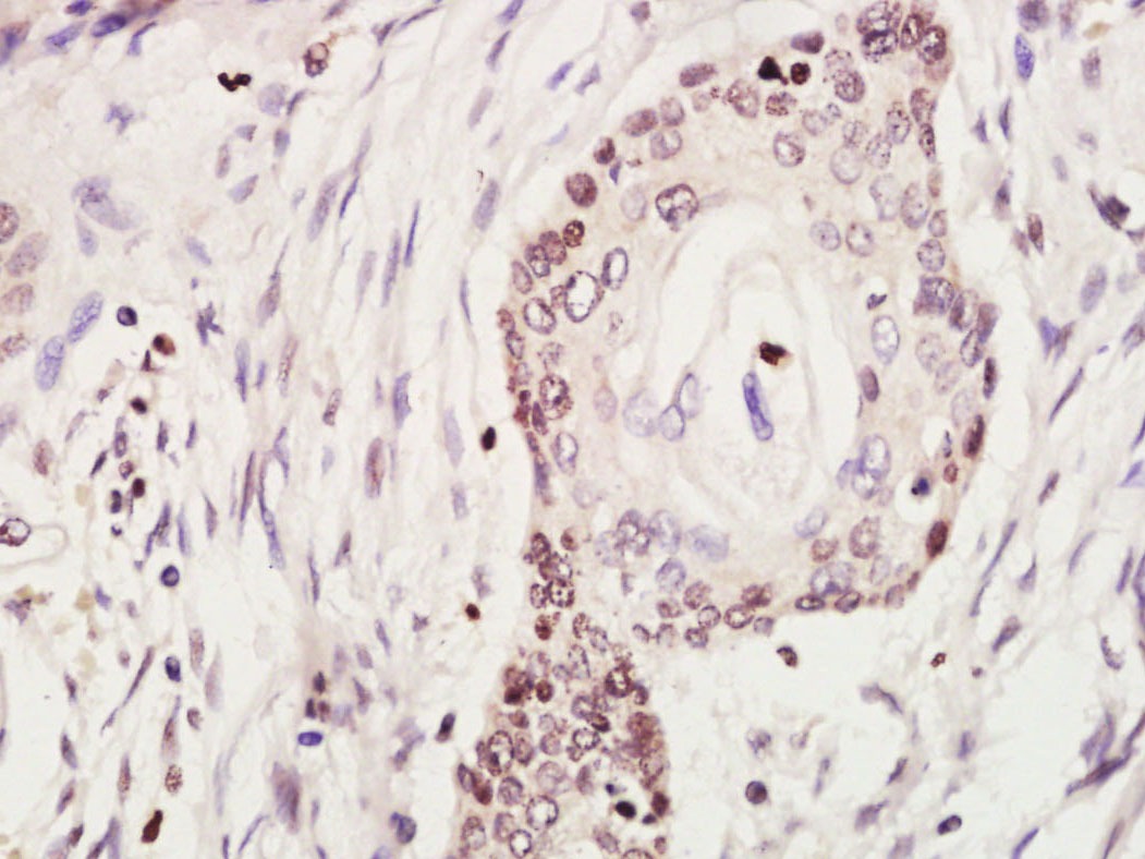 Anti-KEAP1 Polyclonal Antibody 2