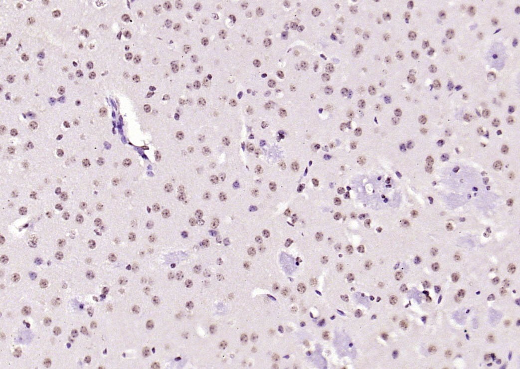 Anti-KEAP1 Polyclonal Antibody 2