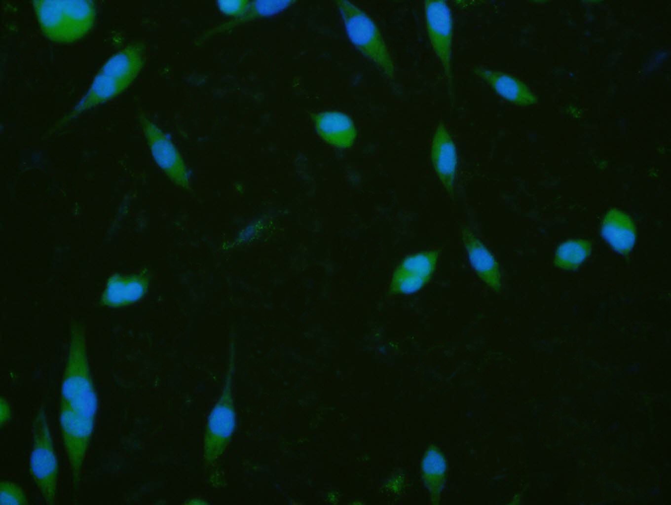 Anti-KEAP1 Polyclonal Antibody 2