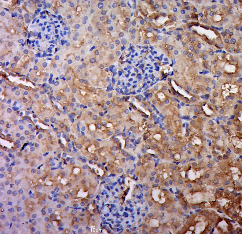 Anti-IL-5 Polyclonal Antibody
