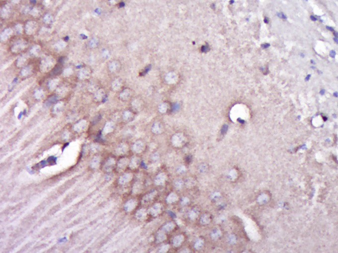Anti-ITGB1 Polyclonal Antibody