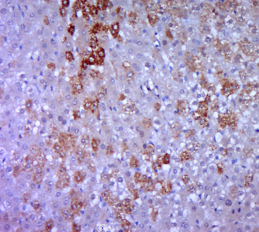 Anti-JAK2 Polyclonal Antibody 2