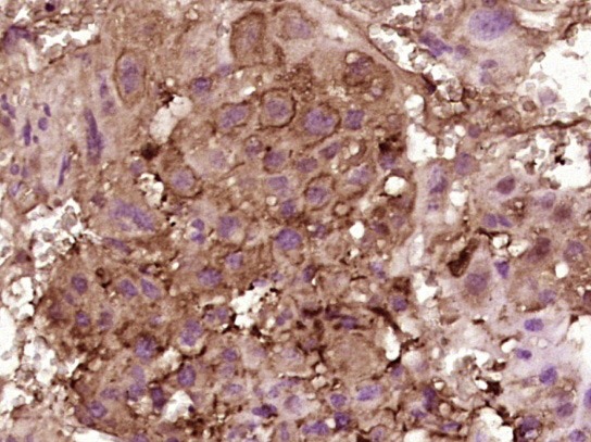 Anti-IL-15 Polyclonal Antibody