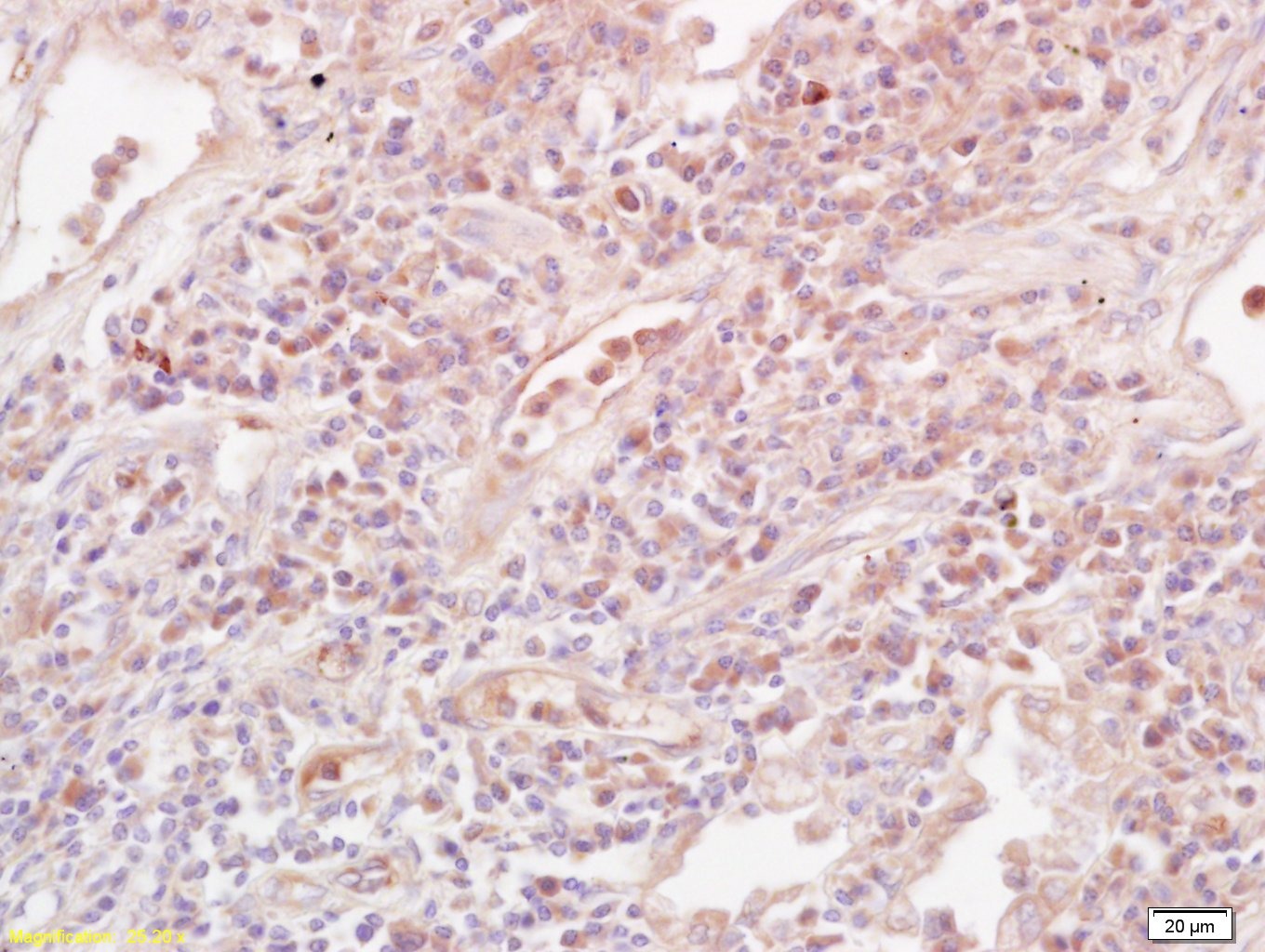 Anti-IL-10 Polyclonal Antibody