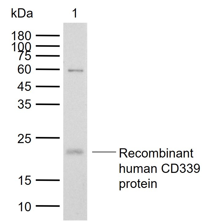 Anti-Jagged 1 Polyclonal Antibody