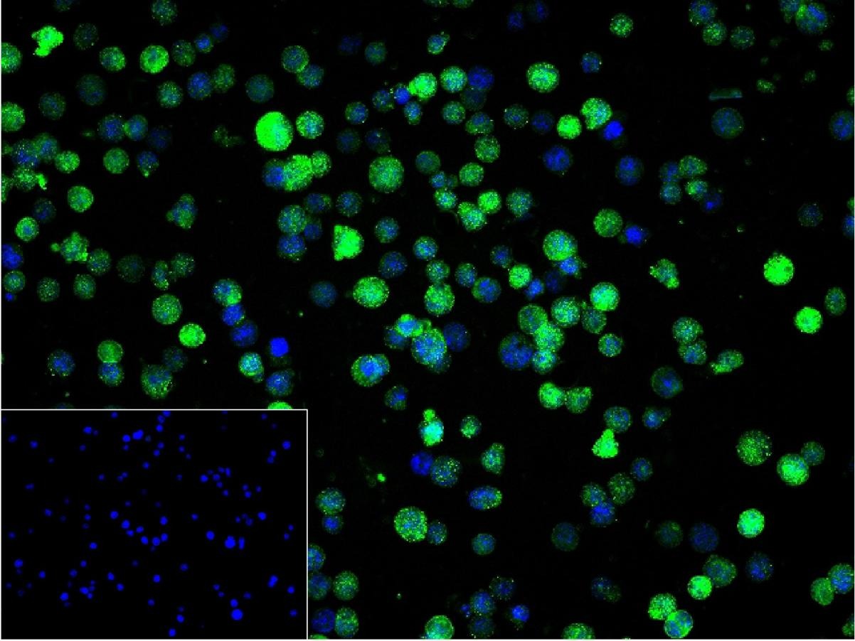 Anti-IFN gamma Polyclonal Antibody 2
