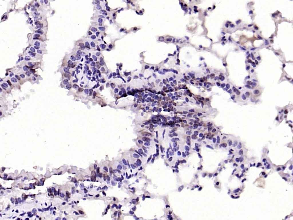 Anti-JAK2 Polyclonal Antibody