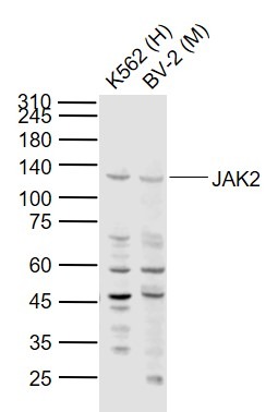 Anti-JAK2 Polyclonal Antibody