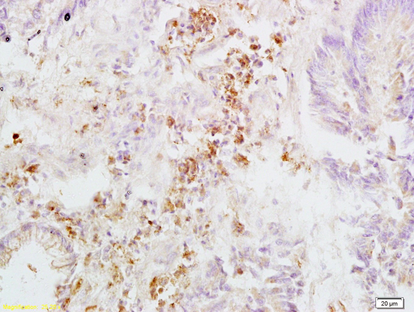 Anti-ITGB3 Polyclonal Antibody