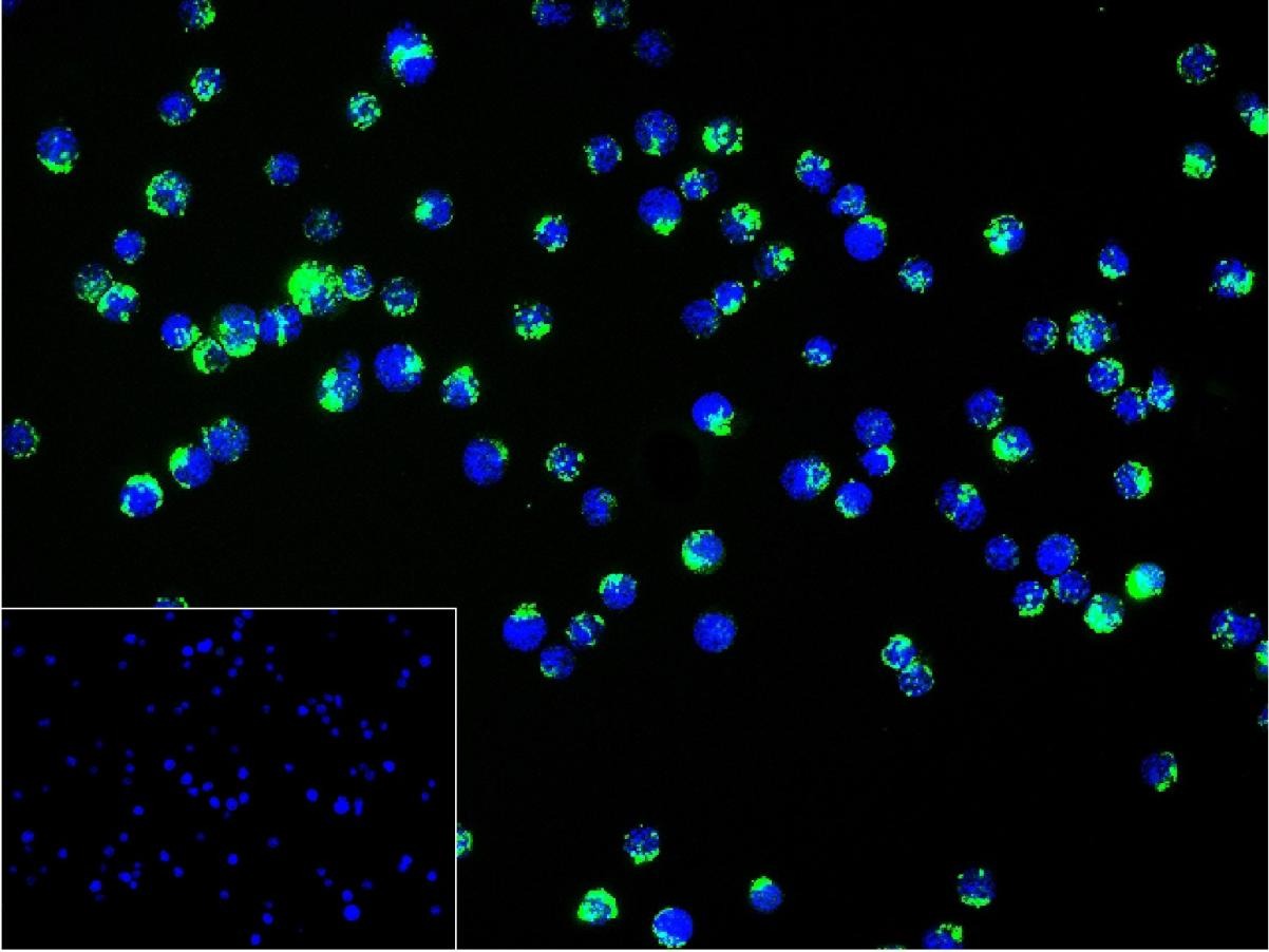 Anti-IFN gamma Polyclonal Antibody