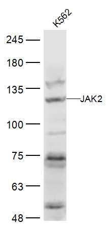 Anti-JAK2 Polyclonal Antibody 2