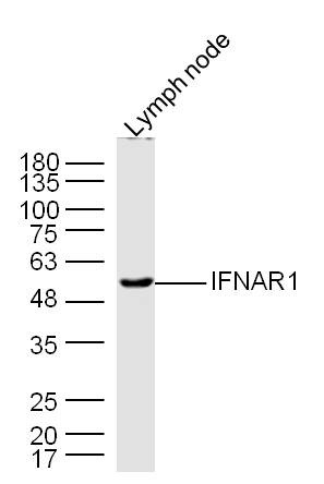 Anti-IFNAR1 Polyclonal Antibody