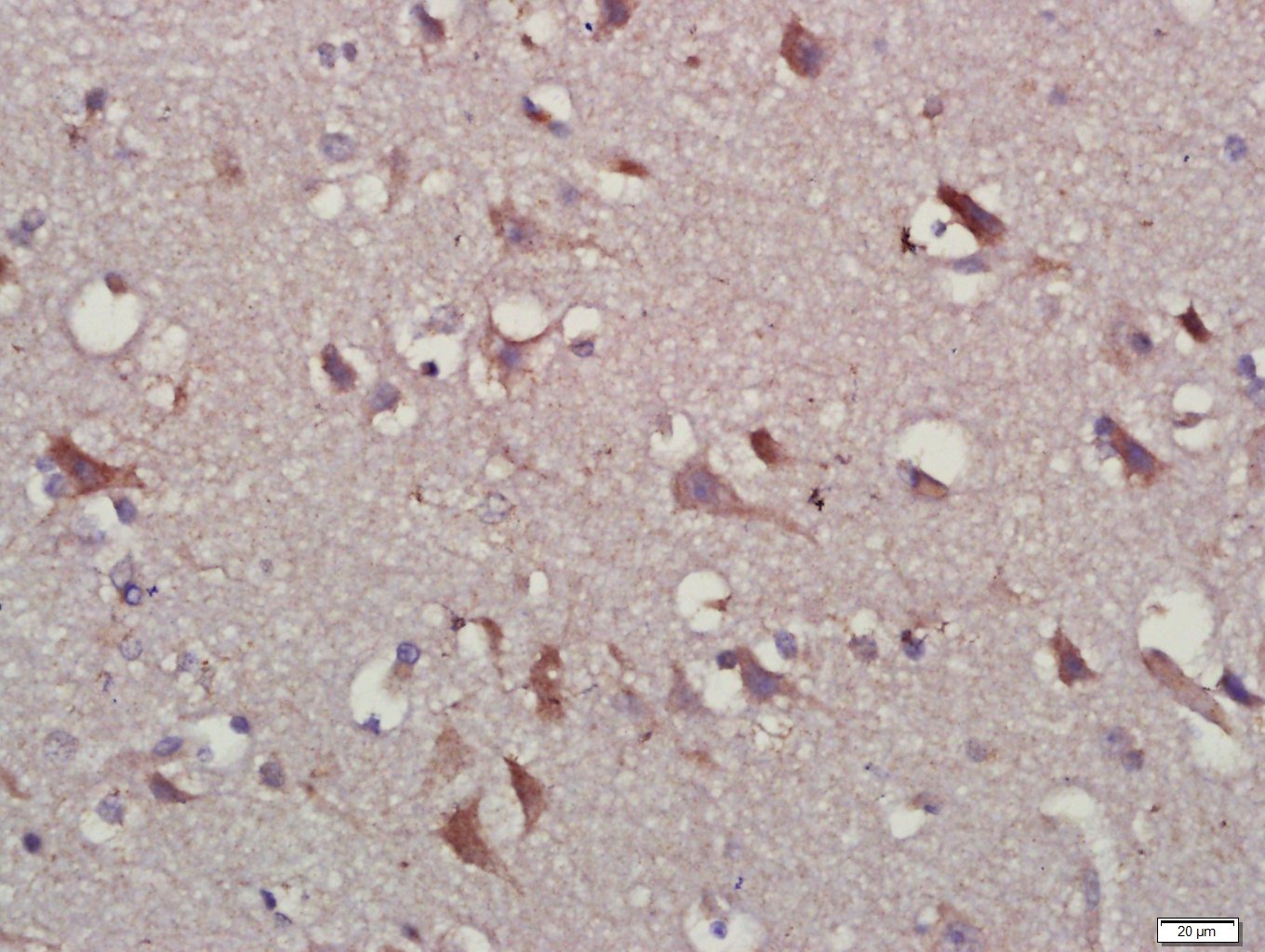 Anti-IL-10 Polyclonal Antibody 3