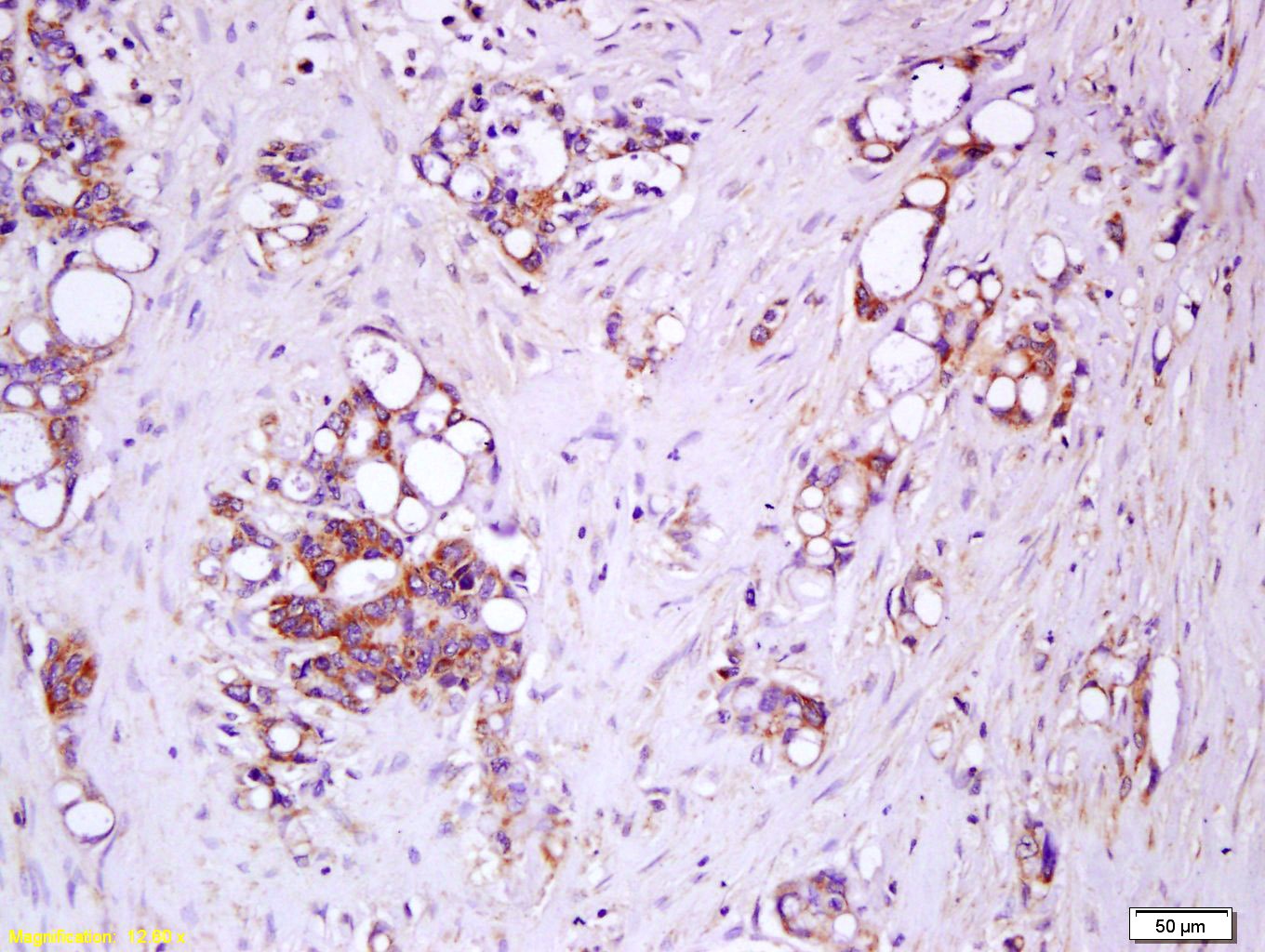 Anti-IL-17Rc Polyclonal Antibody