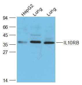 Anti-IL-10R beta/IL-10RB Polyclonal Antibody