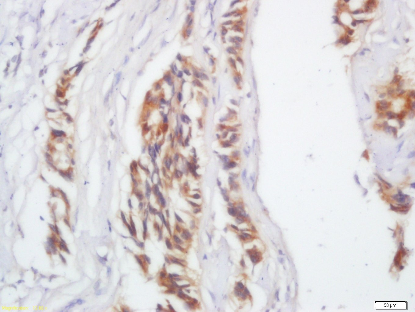 Anti-IL-17C Polyclonal Antibody