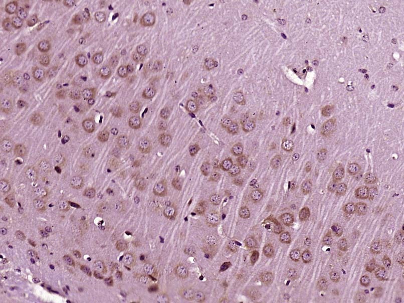 Anti-IGF1/IGF-I Polyclonal Antibody