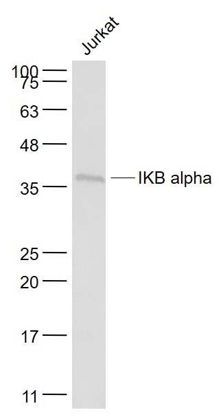 Anti-IkB alpha/NFKBIA Antibody (5M346)