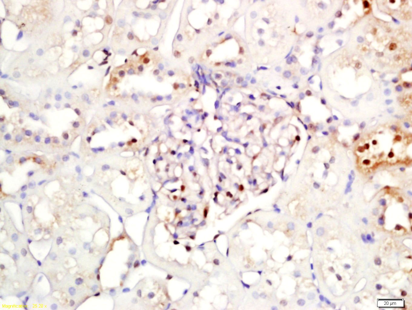 Anti-IkB alpha/NFKBIA Polyclonal Antibody