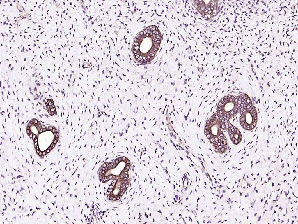 Anti-IGF1/IGF-I Polyclonal Antibody