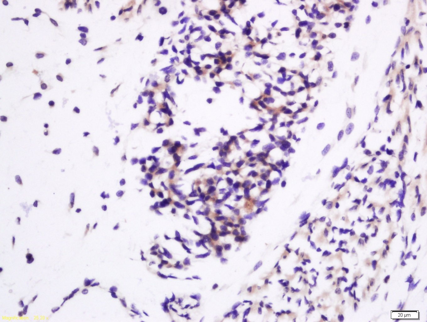 Anti-IGF2/IGF-II Polyclonal Antibody