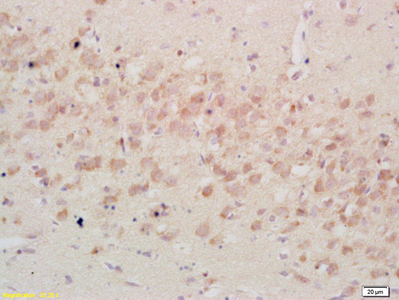 Anti-IGFBP-3 Polyclonal Antibody