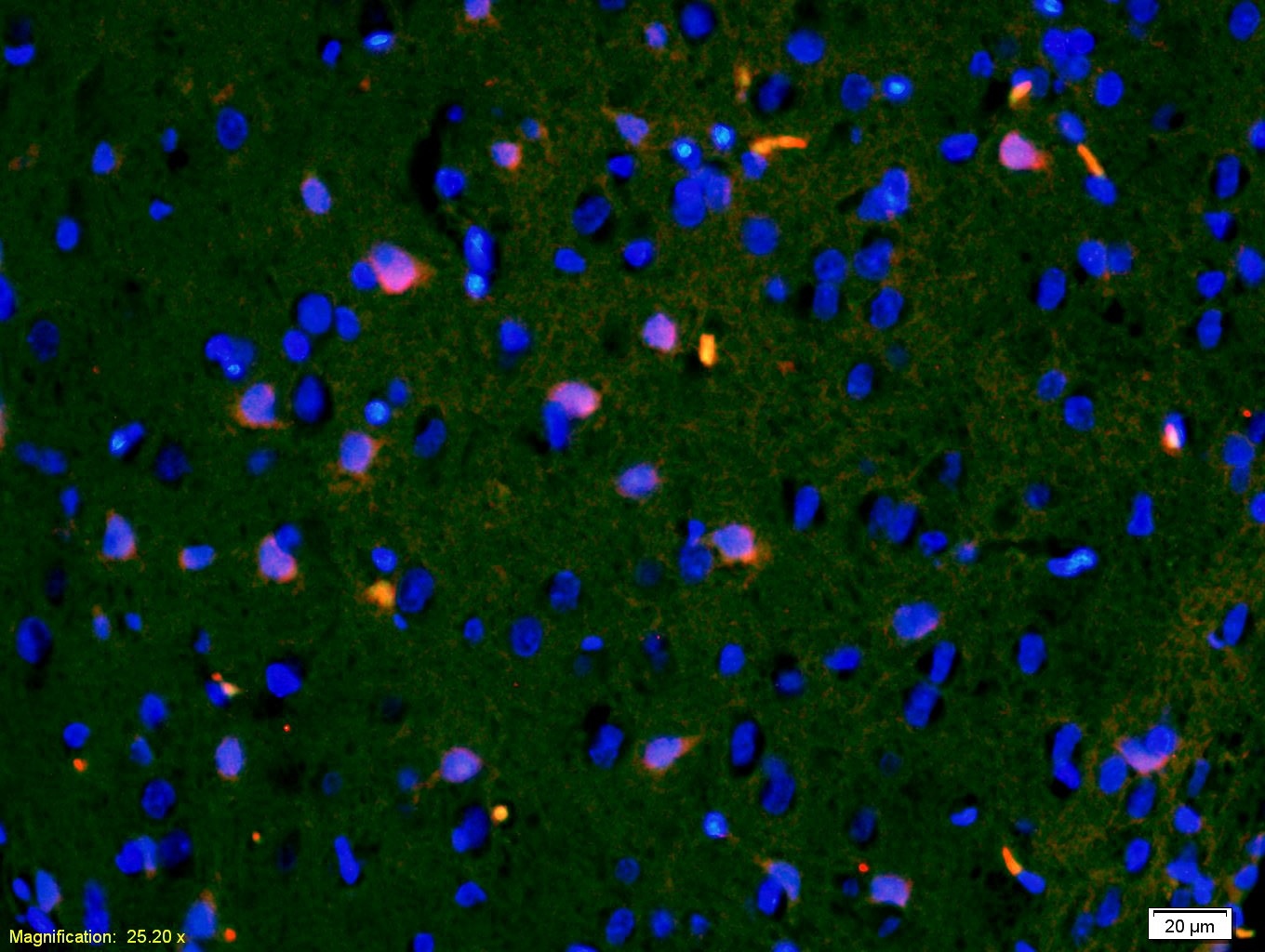 Anti-IGFBP-3 Polyclonal Antibody
