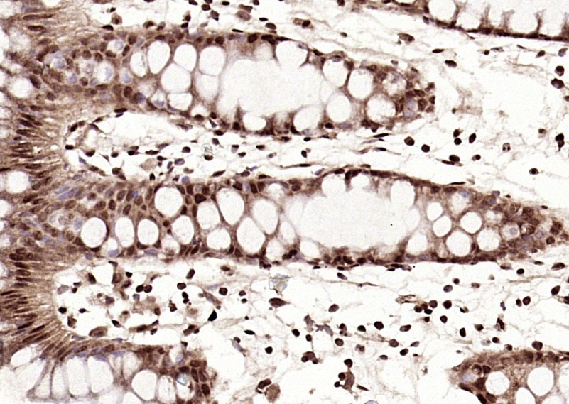 Anti-IGF2BP1 Polyclonal Antibody