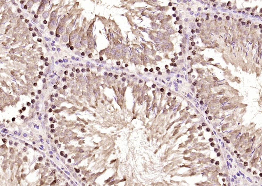 Anti-IGF2BP1 Polyclonal Antibody