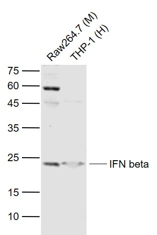Anti-IFN-beta Polyclonal Antibody