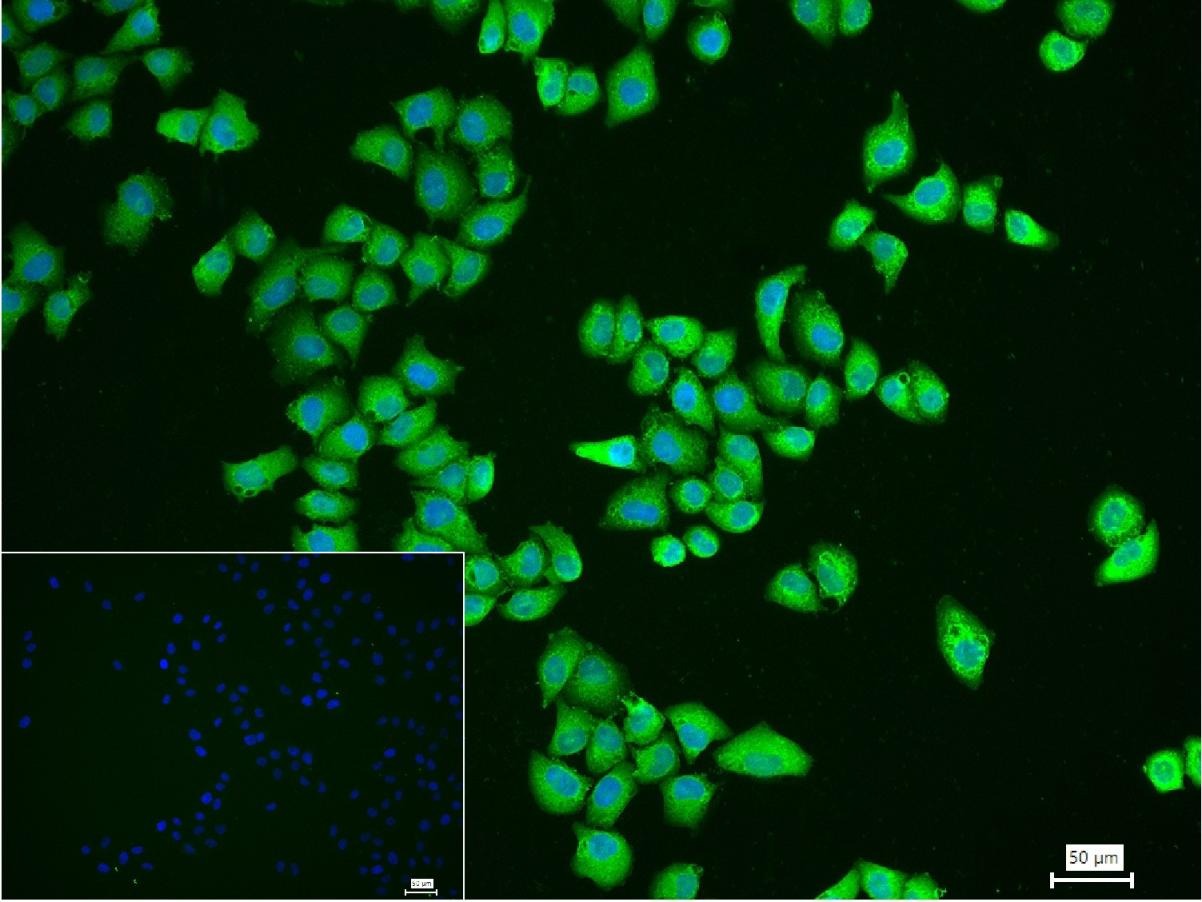 Anti-IkB alpha/NFKBIA Antibody (5M346)