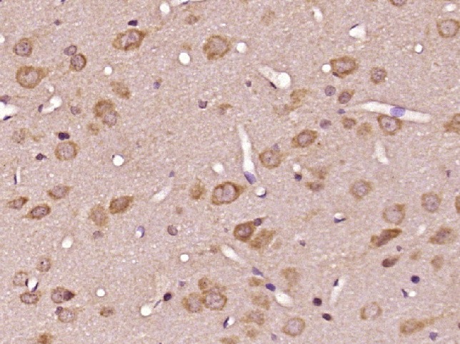 Anti-IGF1/IGF-I Polyclonal Antibody 2